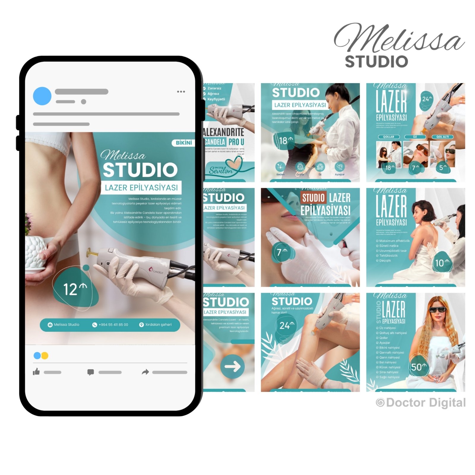 Lazer epilyasiyasi Baku